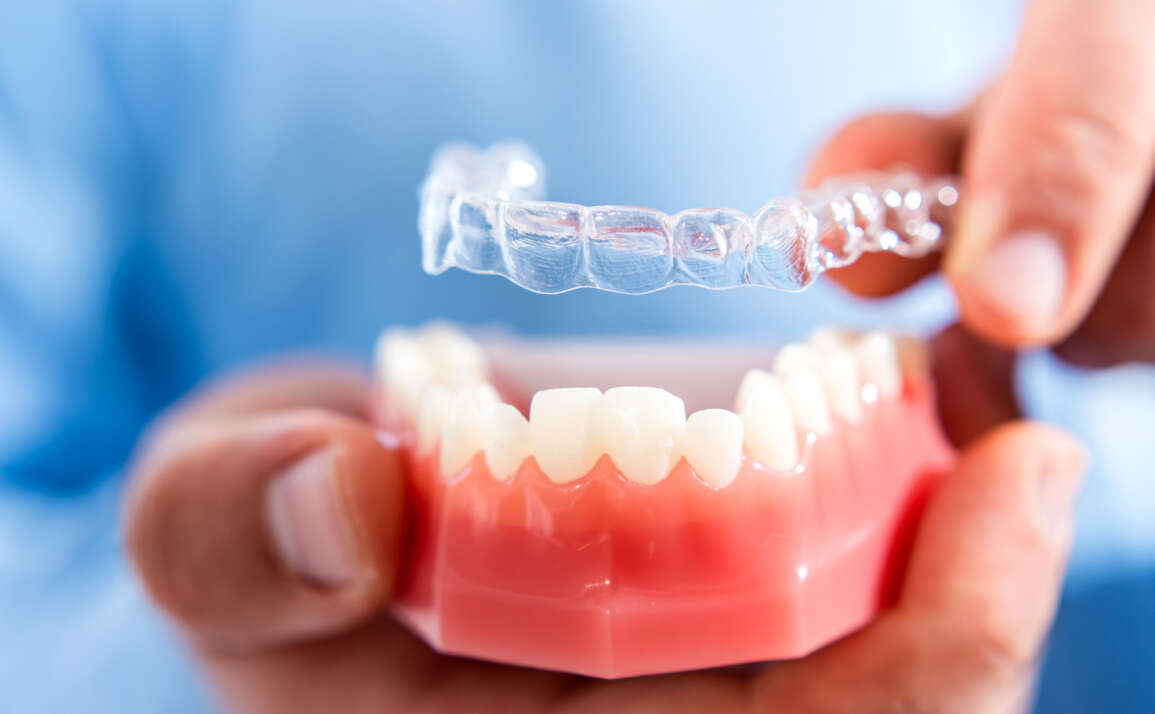 Invisalign vs. Braces