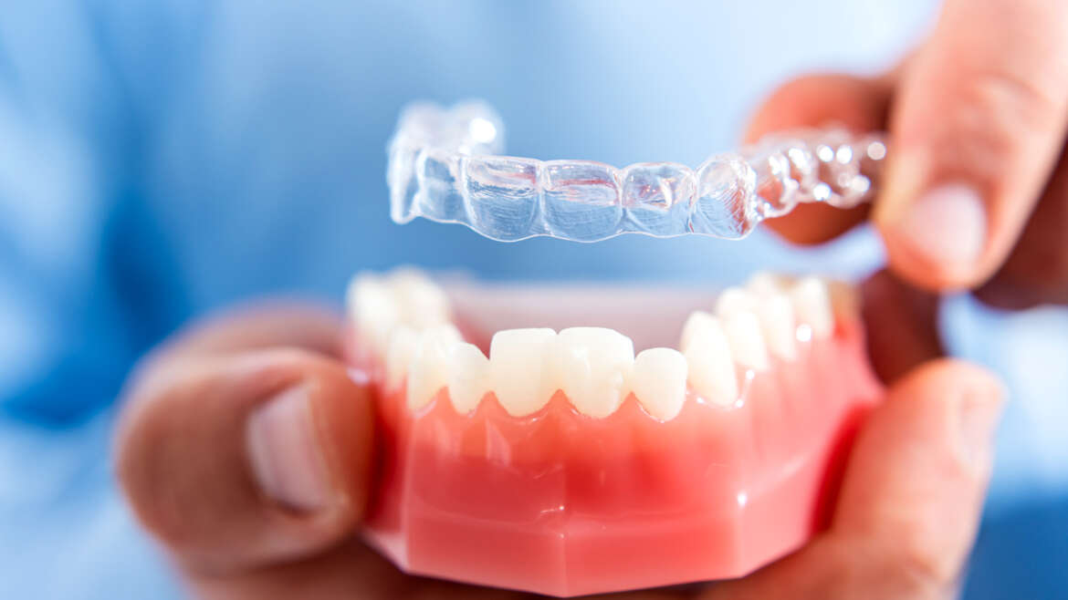 Invisalign vs. Braces
