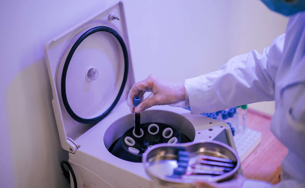 PRP and its role in dentistry