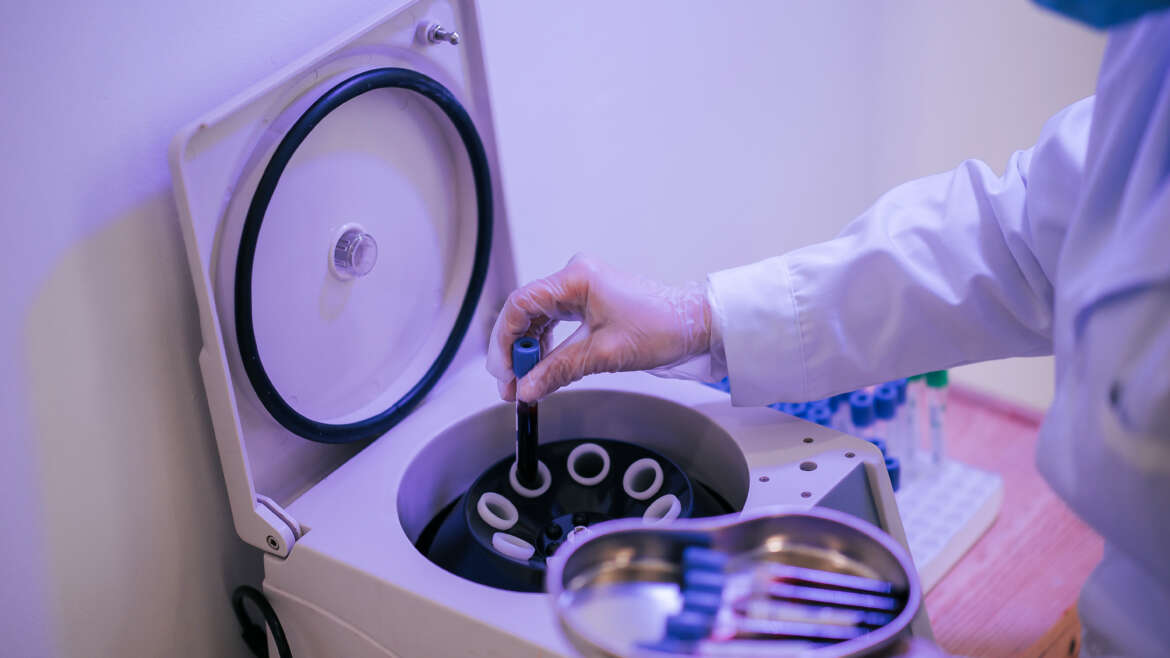 PRP and its role in dentistry