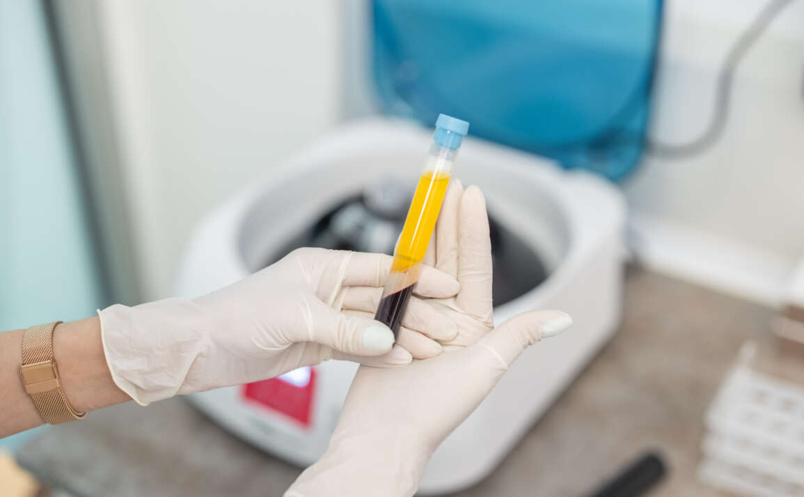FAQ on Platelet Rich Plasma Therapy