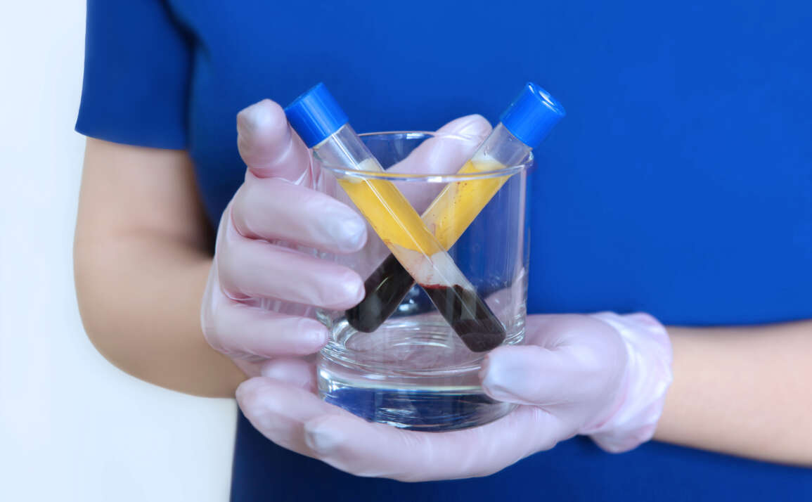 The difference between PRP vs. PRF treatments