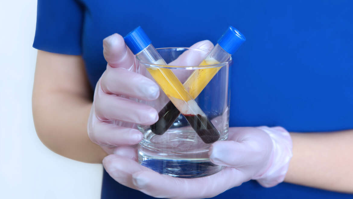 The difference between PRP vs. PRF treatments