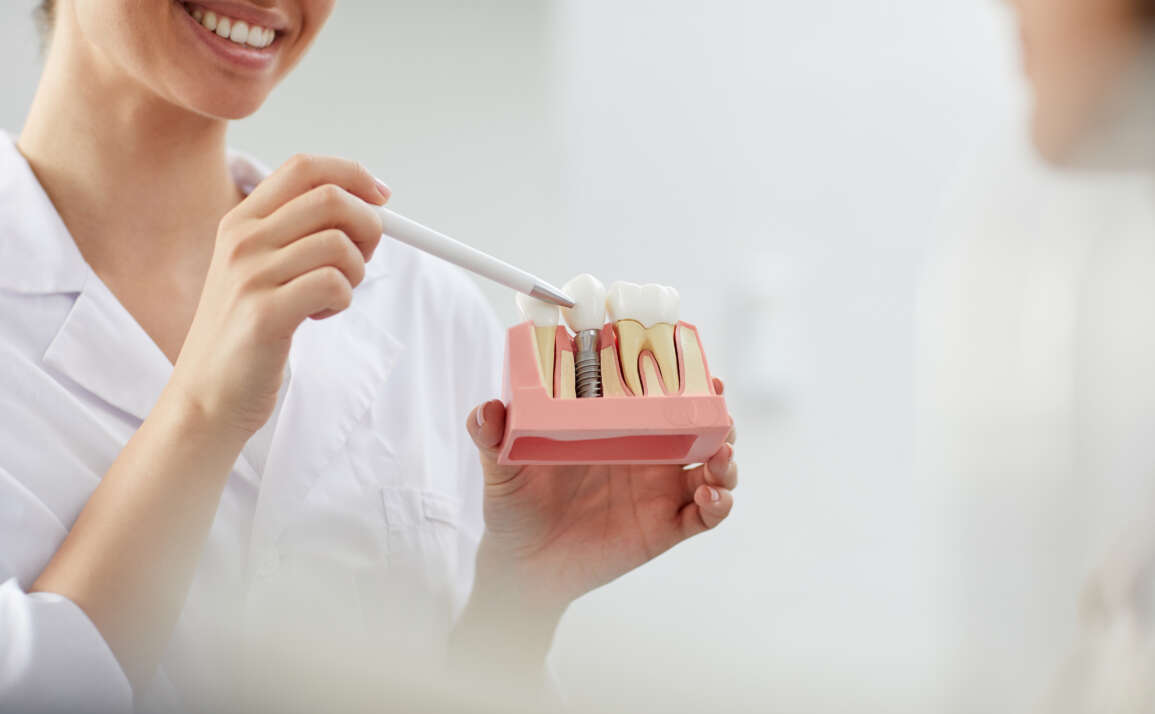 Dental Implant Solutions