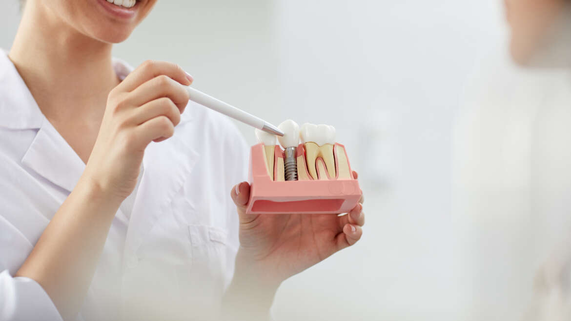 Dental Implant Solutions