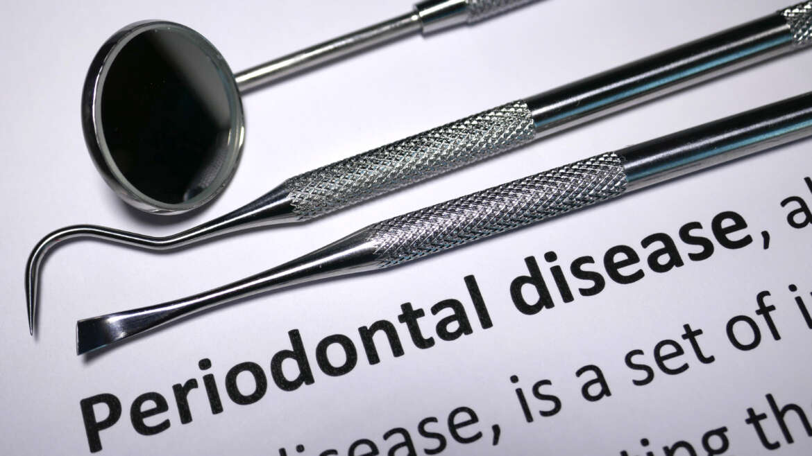 Treating Gum Disease