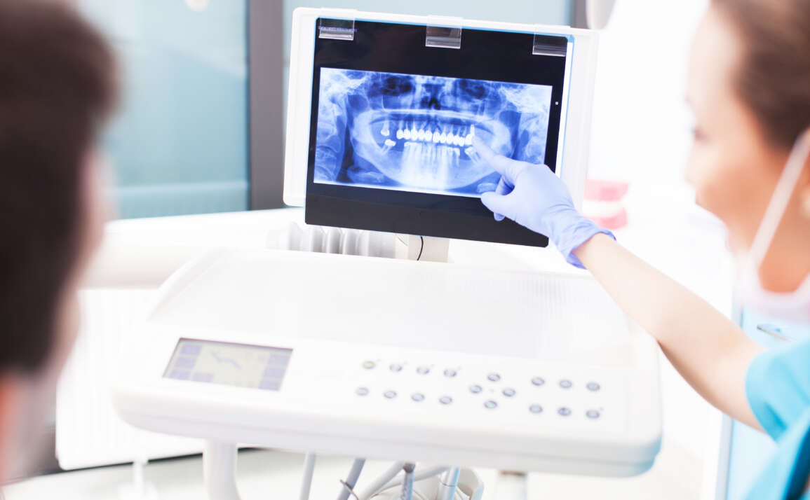 All About Dental X-Rays