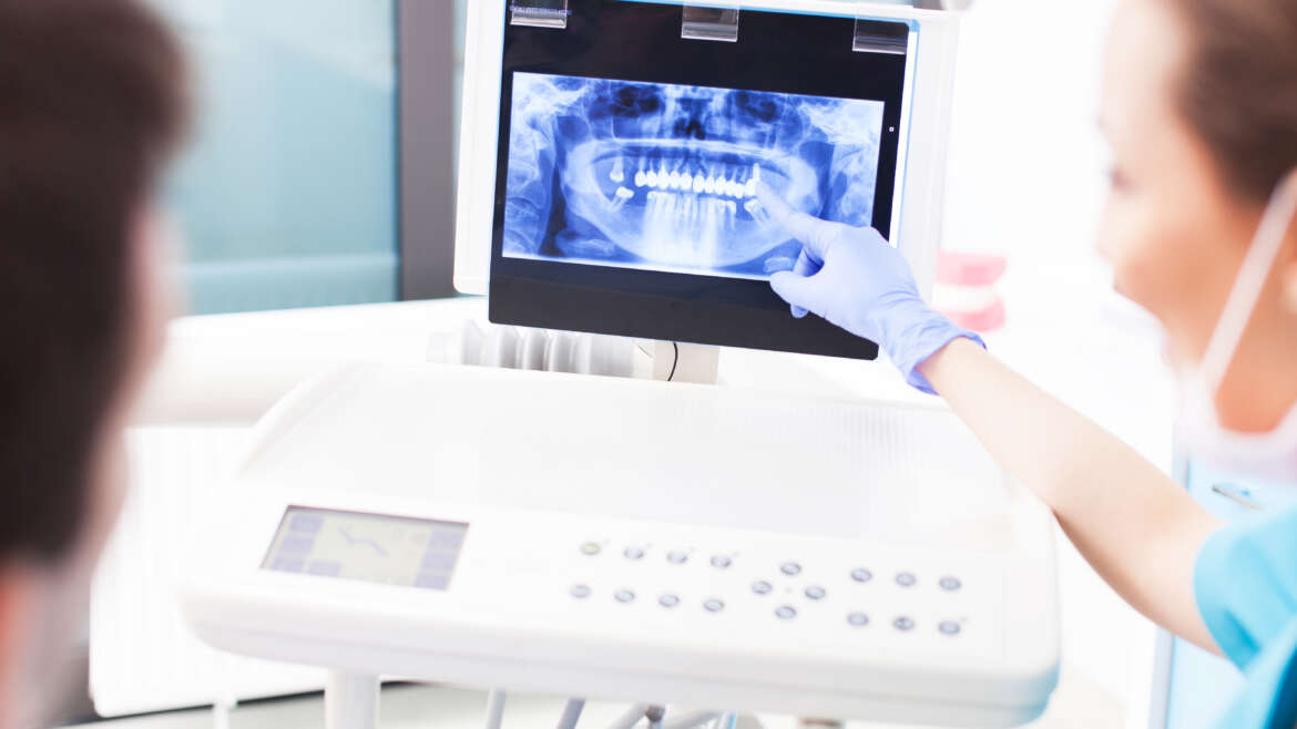 All About Dental X-Rays