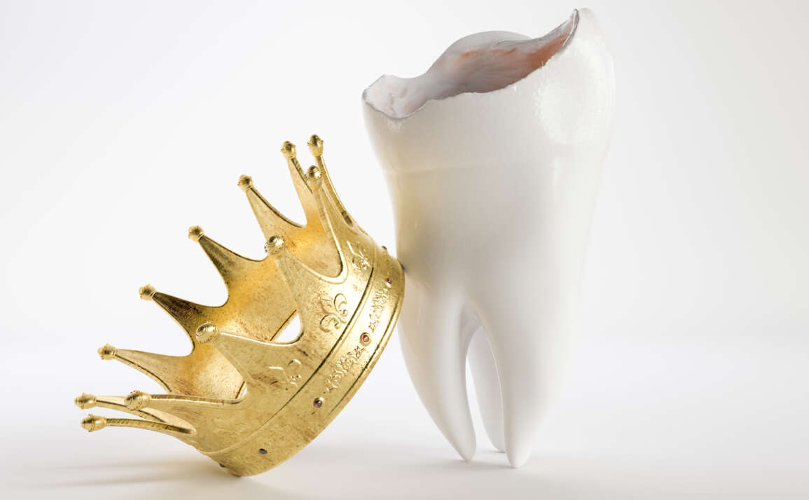 The Royal Treatment, Restorative Solutions- Crowns and Bridges