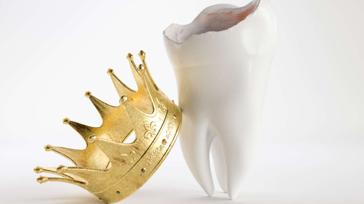 The Royal Treatment, Restorative Solutions- Crowns and Bridges