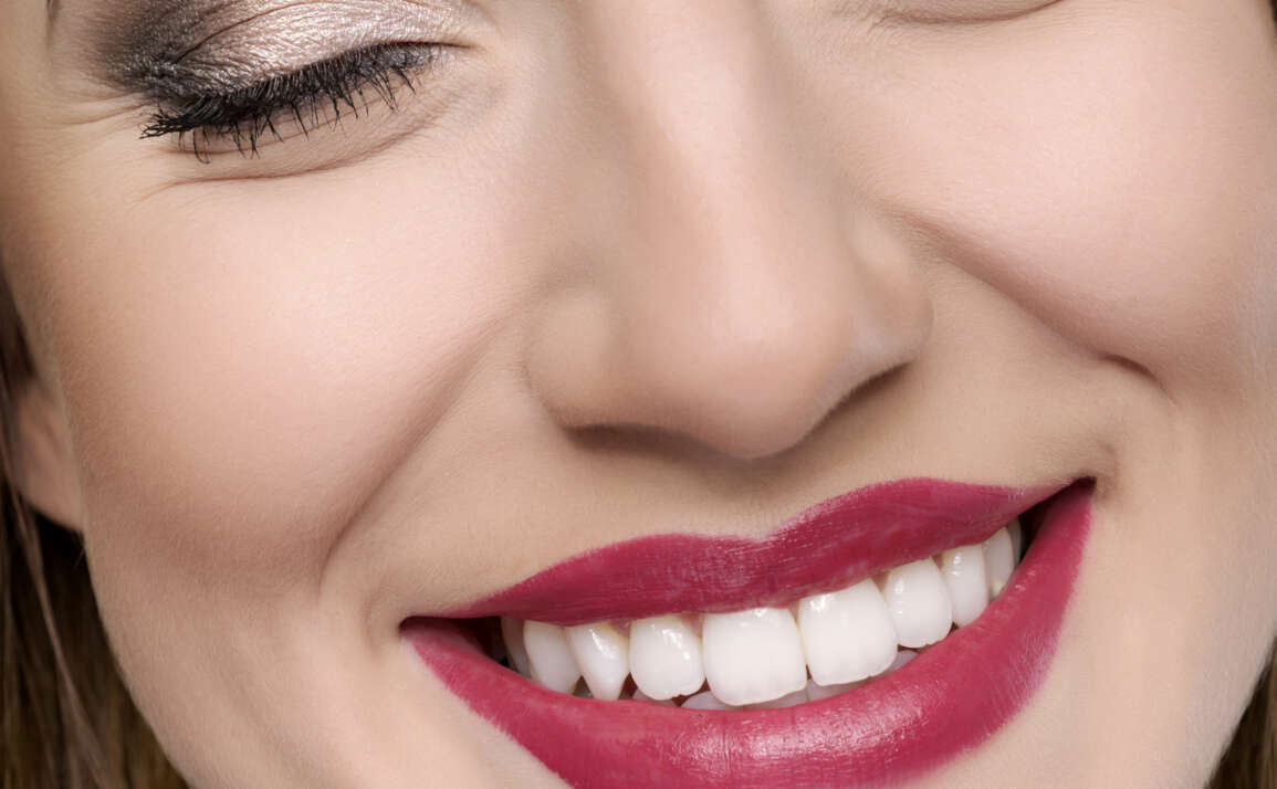 A smile makeover for the New Year