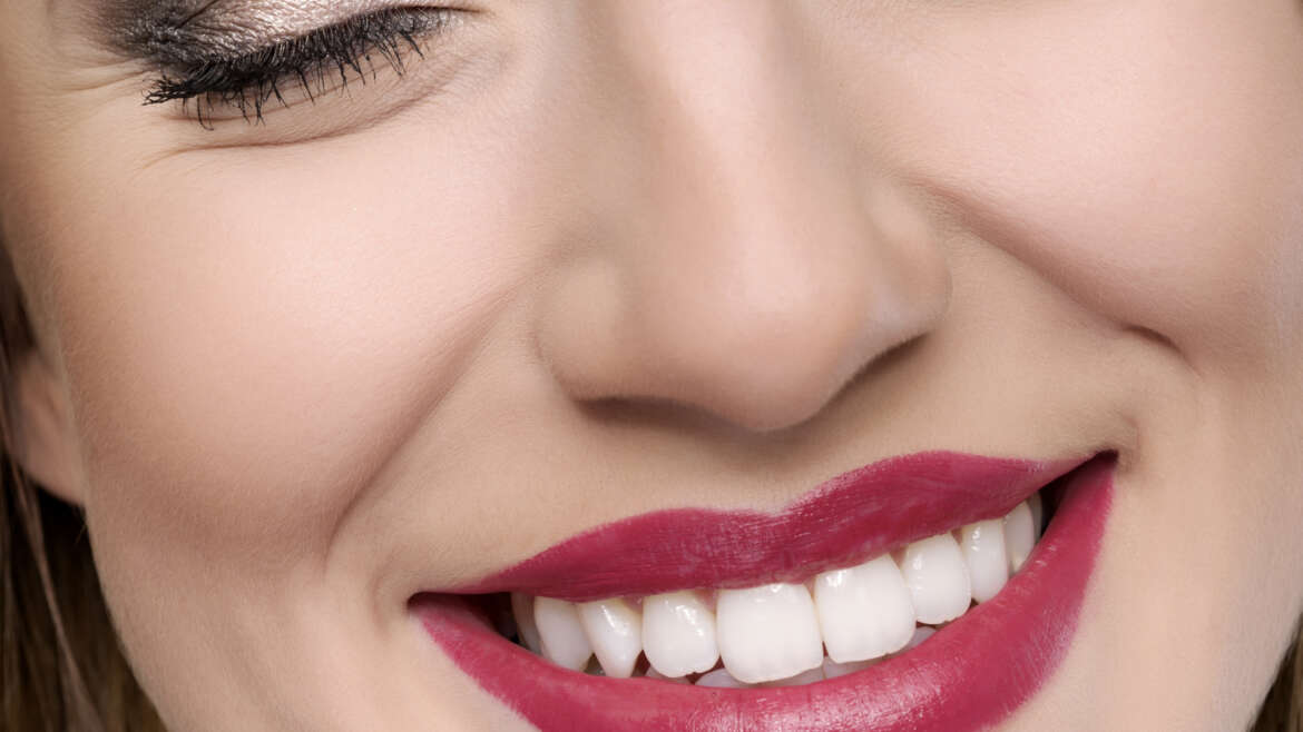 A smile makeover for the New Year