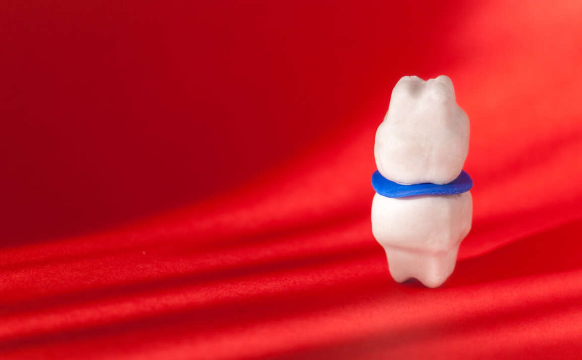 Bruxism Solutions