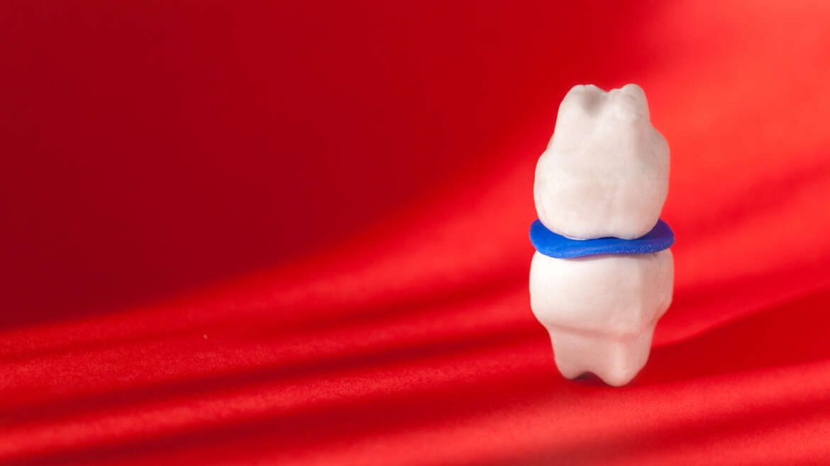 Bruxism Solutions