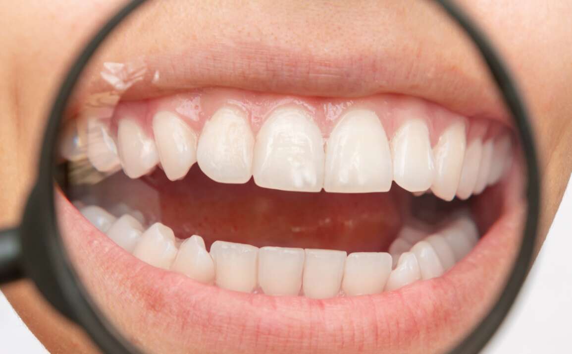 A Deep Look into Strange Tooth Markings and Discolouration