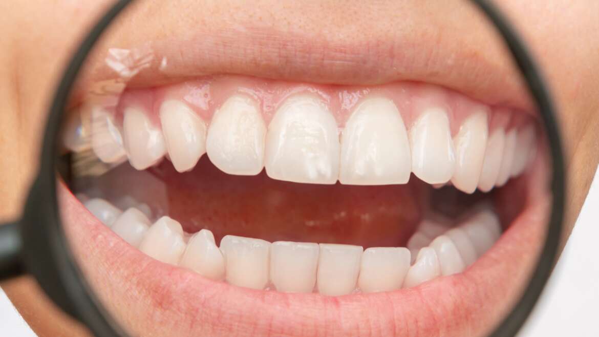 A Deep Look into Strange Tooth Markings and Discolouration