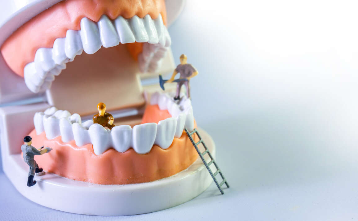 Correcting Tooth Decay