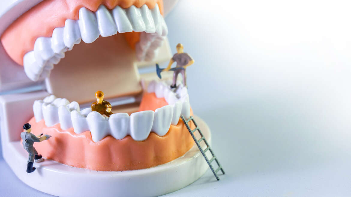 Correcting Tooth Decay
