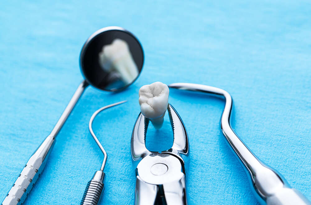 All About Tooth Extractions
