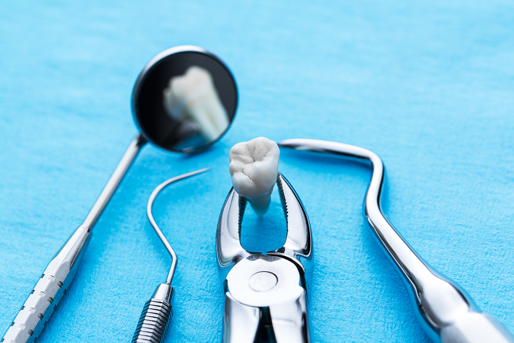 All About Tooth Extractions