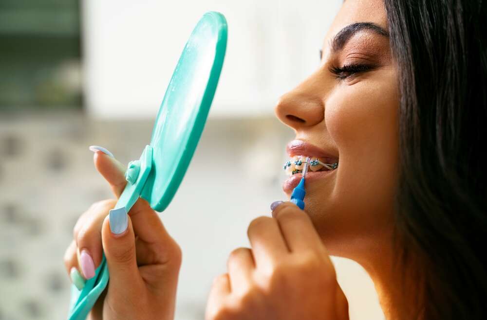 Traditional Braces How to Care for Your Teeth When Under the Wire