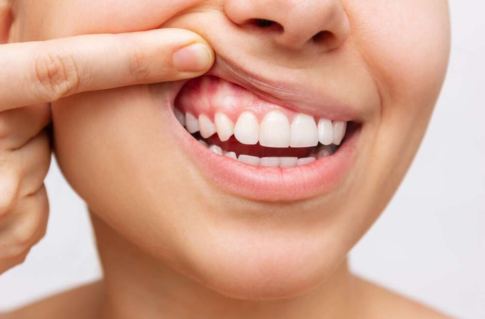 Enhancing Brain Health: The Integral Role of Gum Disease Treatment
