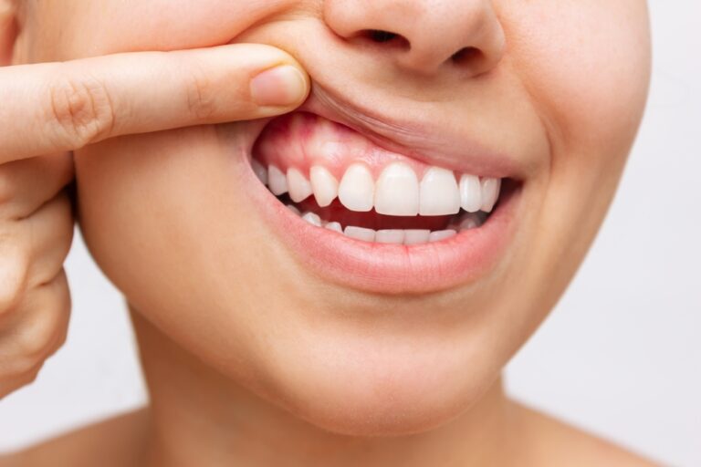 Enhancing Brain Health: The Integral Role of Gum Disease Treatment
