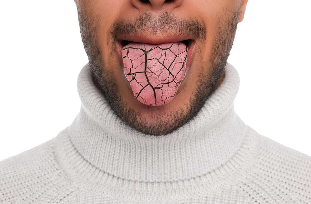 Winter Dryness: Navigating the Challenges of Dry Mouth During Cold Months