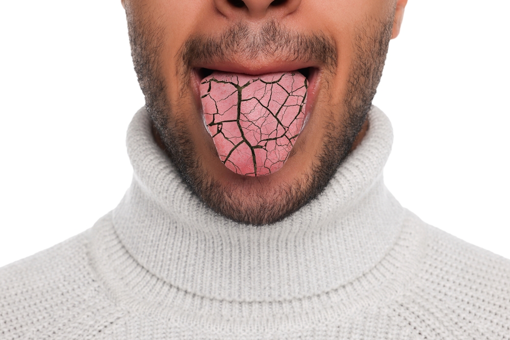 Winter Dryness: Navigating the Challenges of Dry Mouth During Cold Months