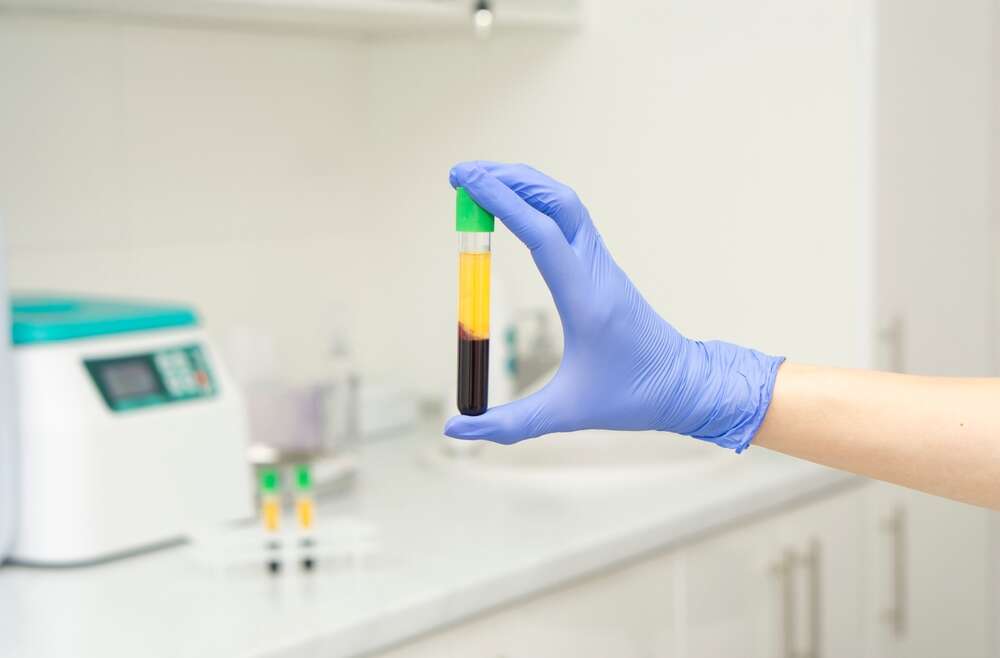 Platelet-Rich Plasma Therapy: The Golden Liquid Elevating Oral Surgery Outcomes