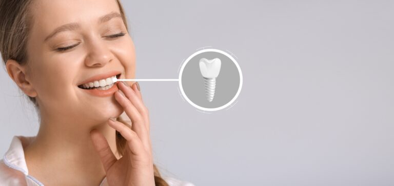 From Function to Aesthetics: The Multifaceted Perks of All-on-4 Implants