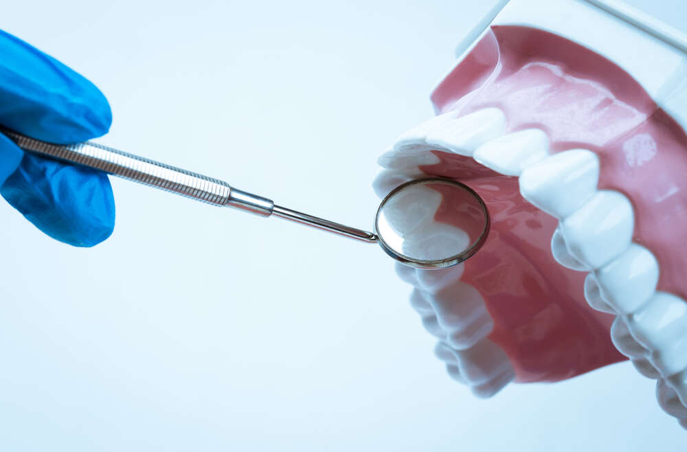 Maximizing Tooth Life: Dental Inlays & Onlays