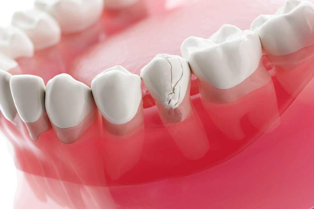 Emergency Dental Care in Toronto: When to Seek Immediate Help