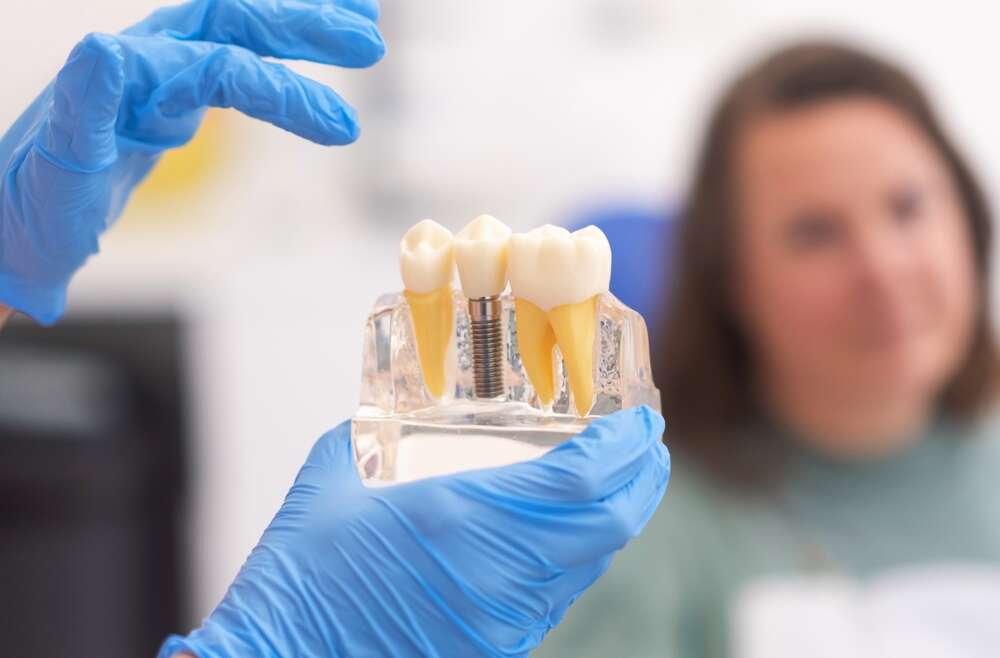 Frequently Asked Questions: Dental Implants in Toronto