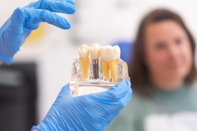 Frequently Asked Questions: Dental Implants in Toronto