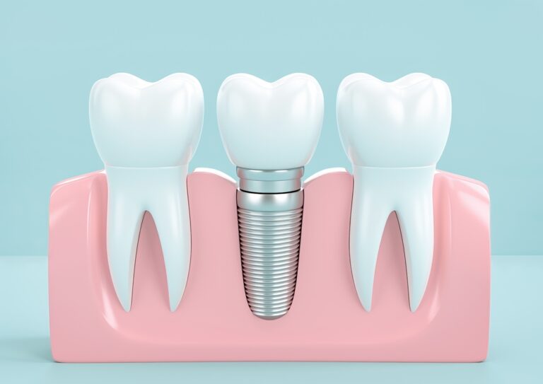 A Closer Look at Dental Implants and Pain