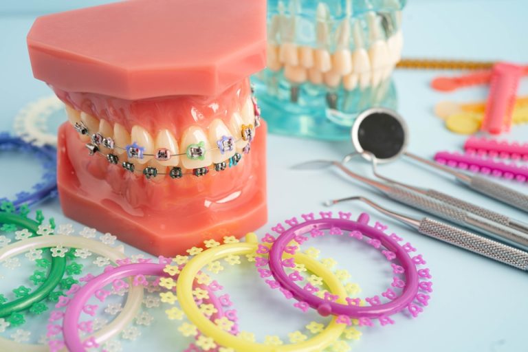 Orthodontic Myths Busted: What Toronto Patients Need to Know