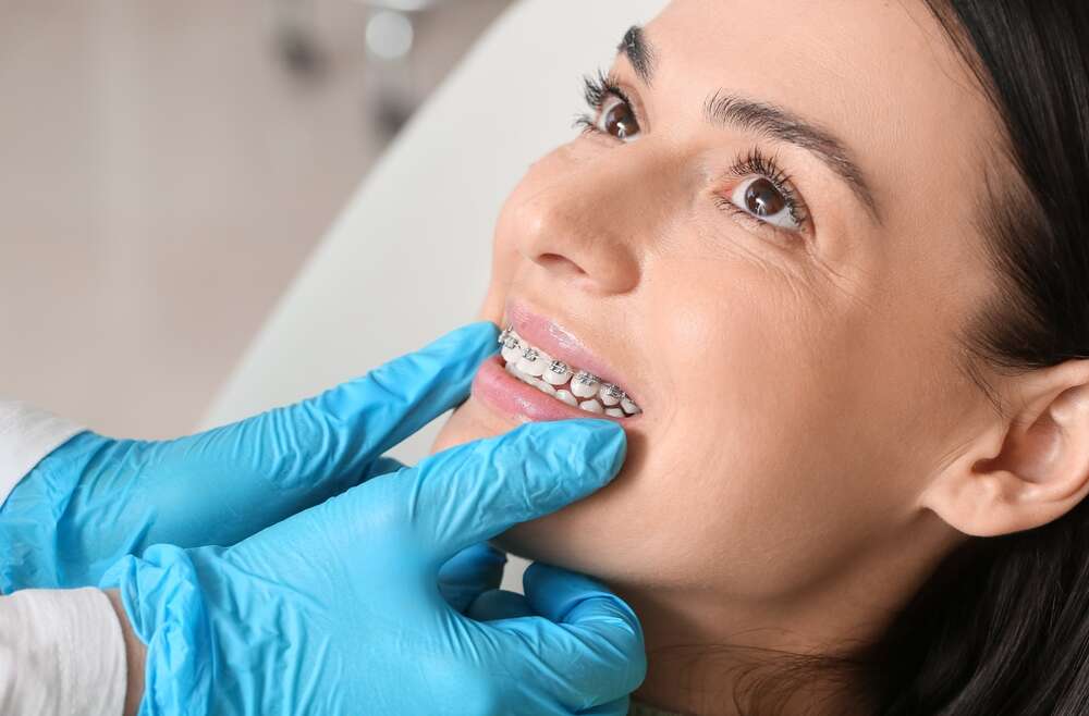 Insights on Orthodontic Solutions for Straighter Teeth Without Braces
