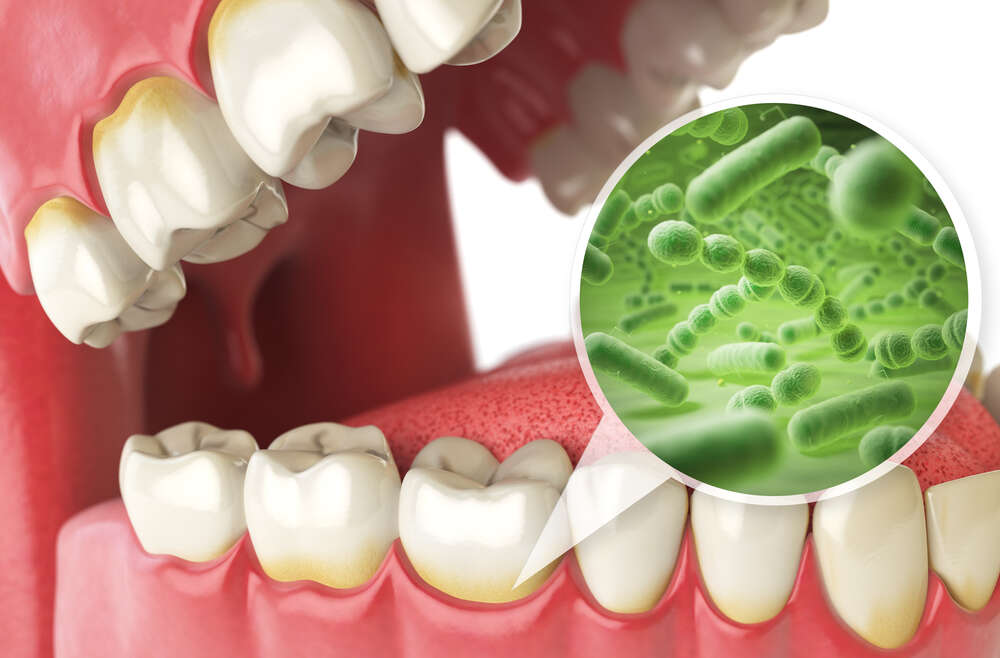 Your Guide to Gum Disease Treatment Options