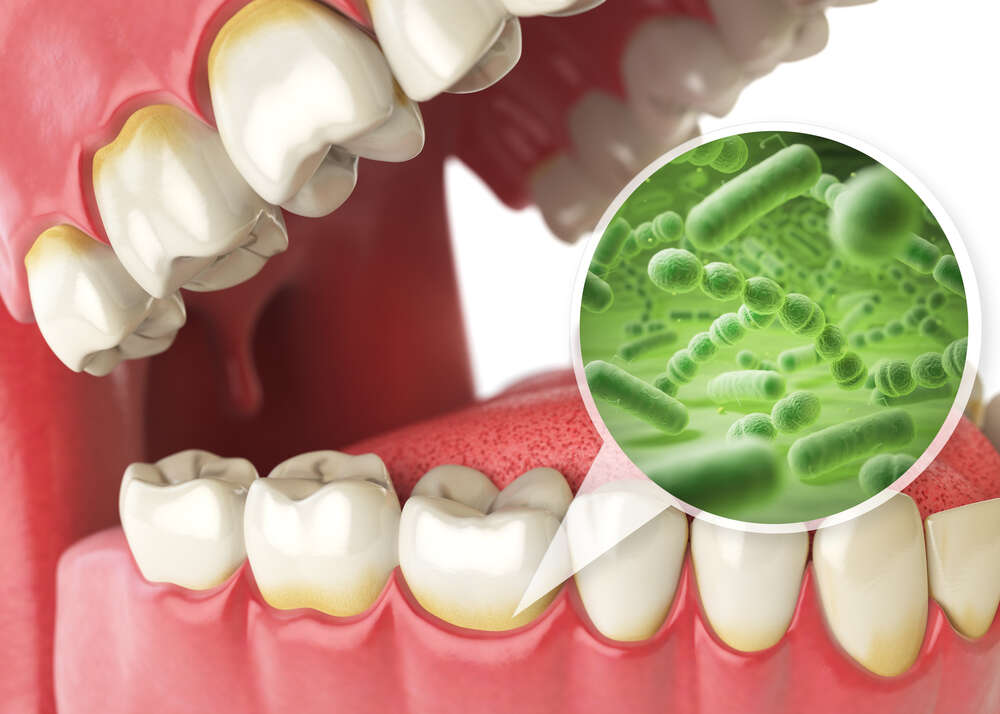 Your Guide to Gum Disease Treatment Options