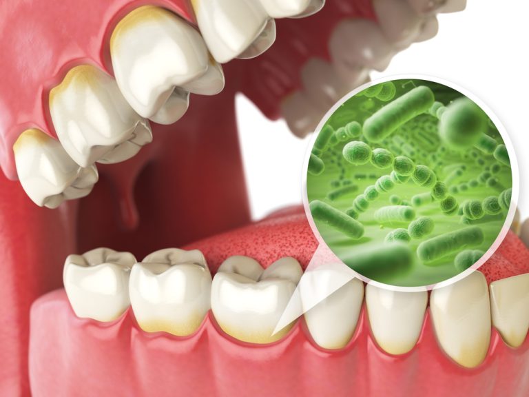 Your Guide to Gum Disease Treatment Options