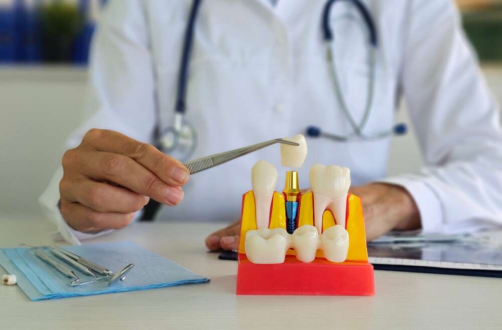 Ensuring Dental Implant Success