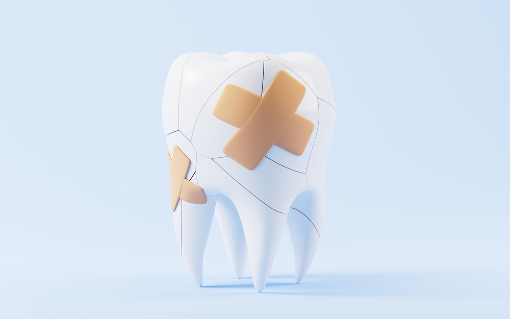 Cracked or Broken Tooth? Here’s What You Need to Do Right Now