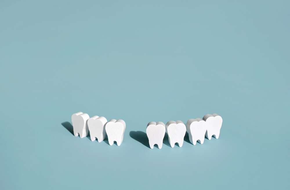 When Tooth Extractions are Necessary