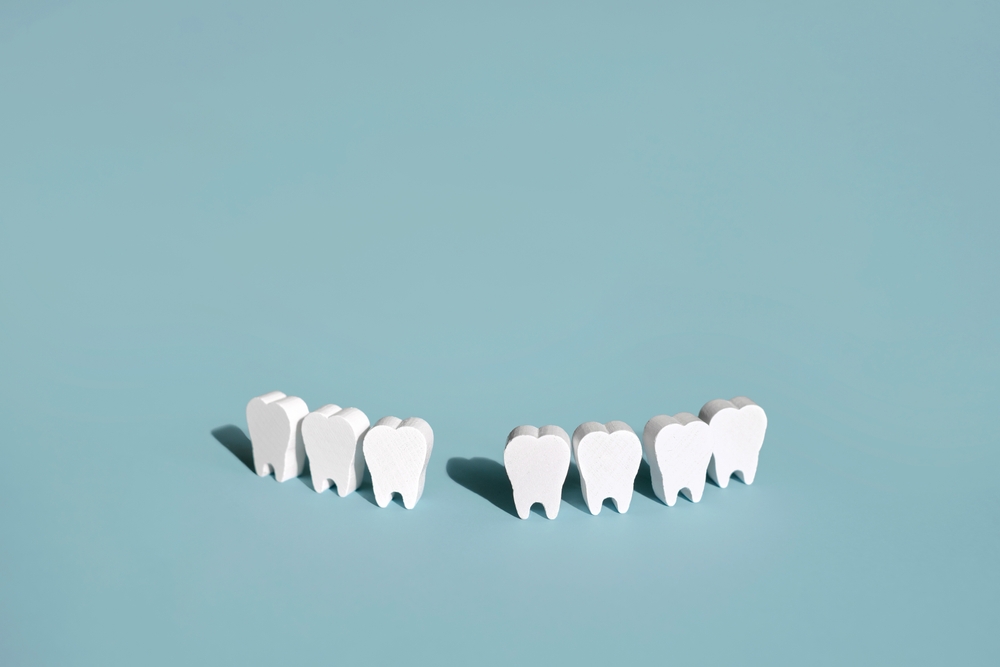 When Tooth Extractions are Necessary