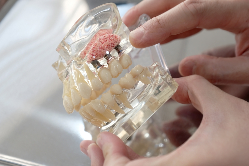 Implant Dentistry
