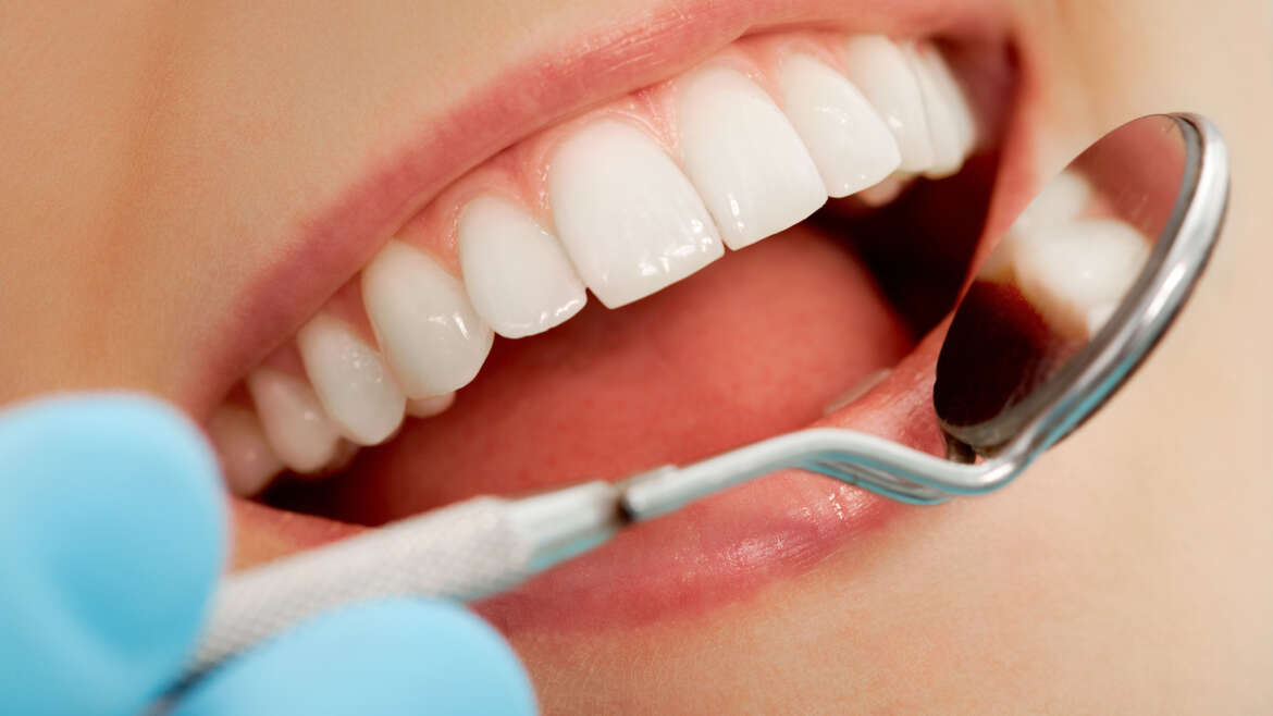 Cosmetic Dentistry Myths Debunked