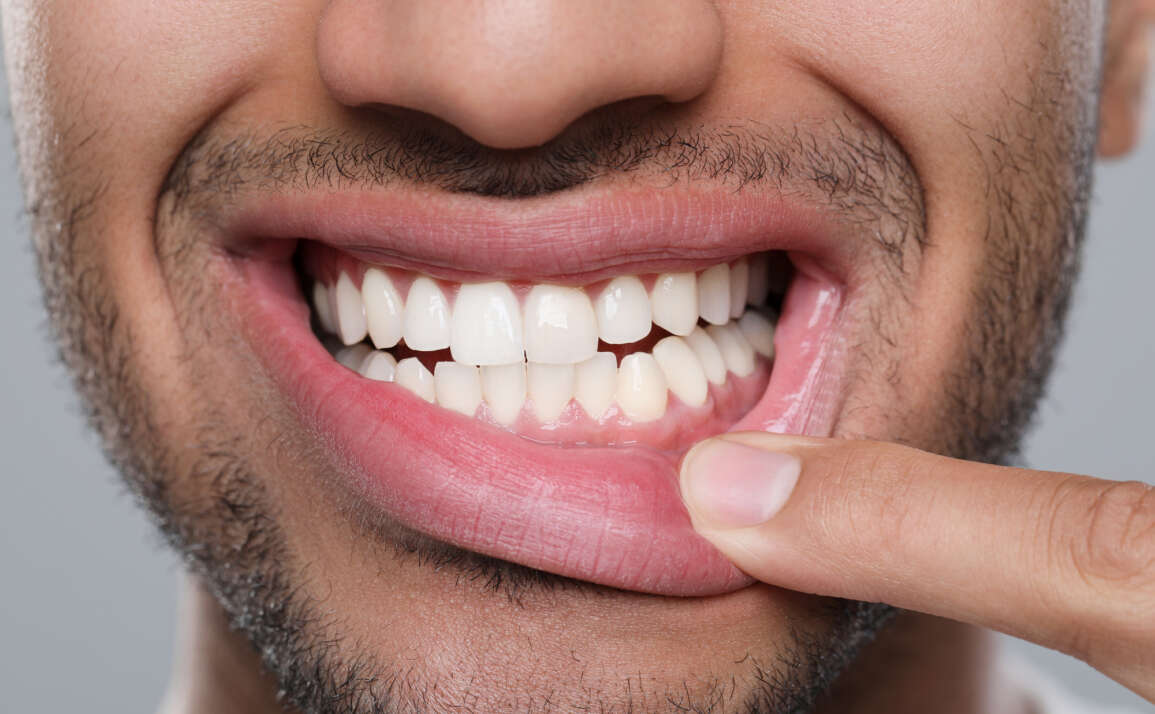What Your Gums Are Trying to Tell You: Signs Only a Dental Office in Yorkville Would Catch Early