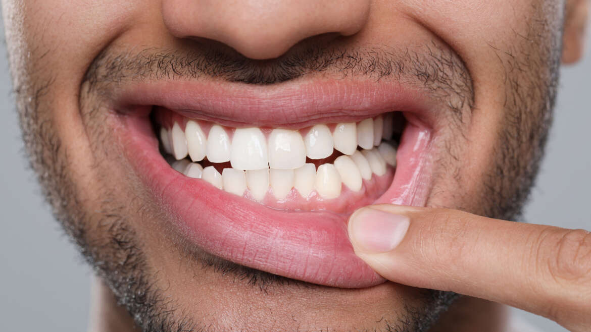 What Your Gums Are Trying to Tell You: Signs Only a Dental Office in Yorkville Would Catch Early