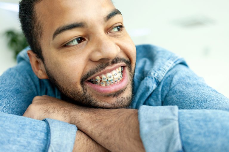 Adult Orthodontics: Transforming Smiles at Any Age